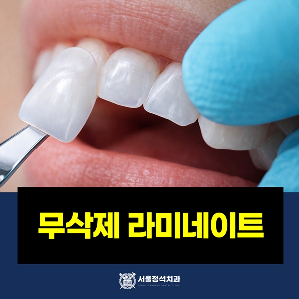 무삭제 라미네이트 심미치료